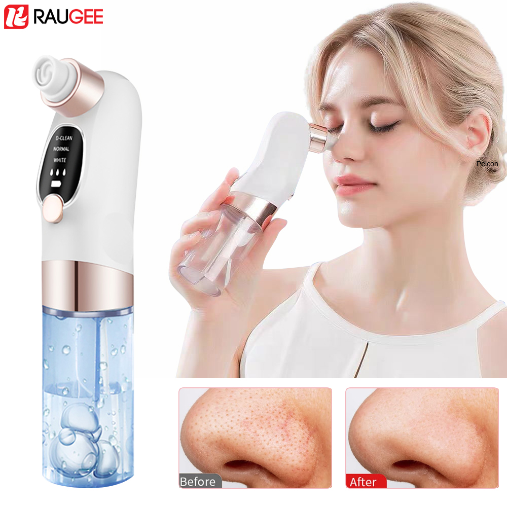 Blackhead Remover Electric Bla - Air Bubble Remover recensione e prezzo