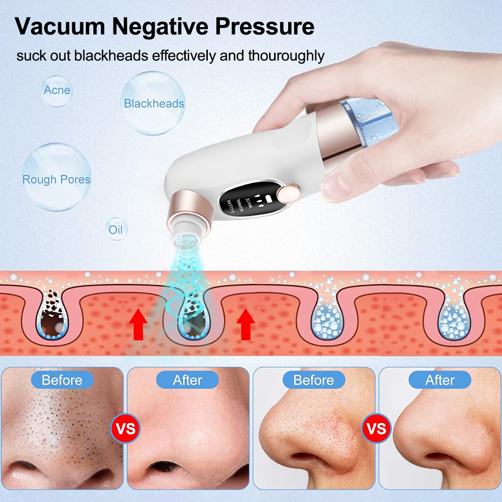 Blackhead Remover Electric Bla - Air Bubble Remover recensione e prezzo